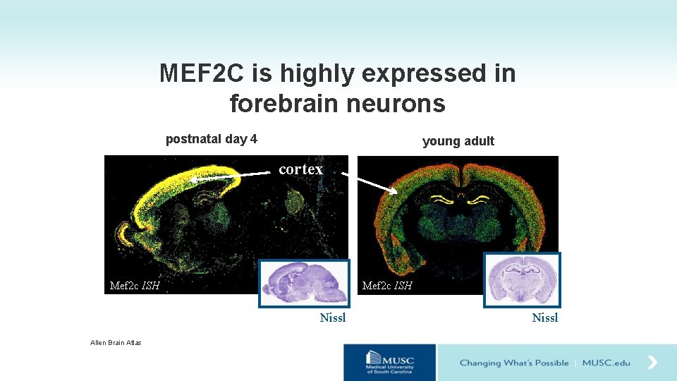 MEF 2 C is highly expressed in forebrain neurons postnatal day 4 young adult