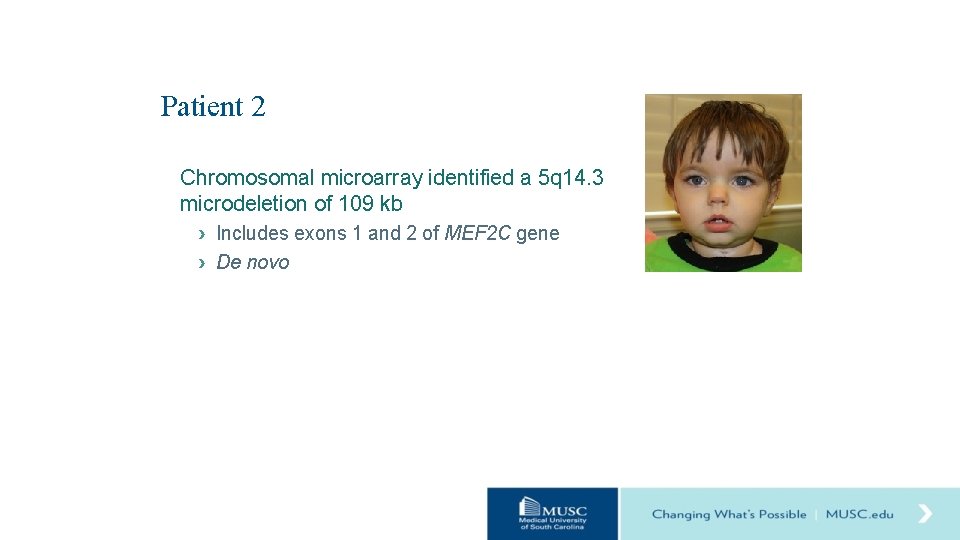 Patient 2 Chromosomal microarray identified a 5 q 14. 3 microdeletion of 109 kb