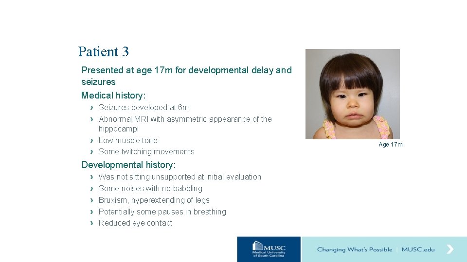 Patient 3 Presented at age 17 m for developmental delay and seizures Medical history: