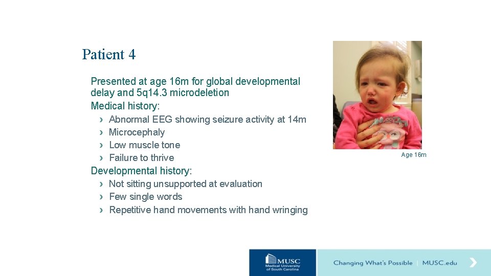 Patient 4 Presented at age 16 m for global developmental delay and 5 q