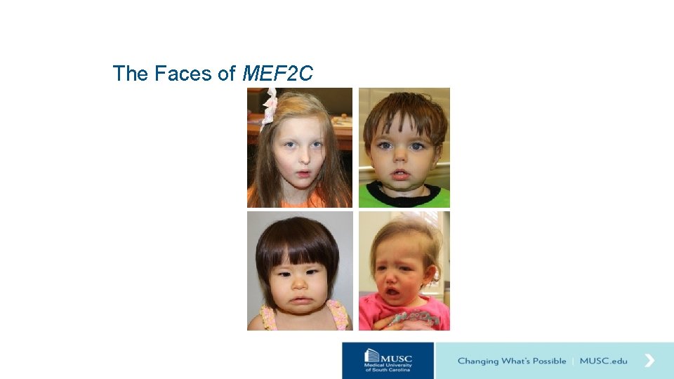 The Faces of MEF 2 C 