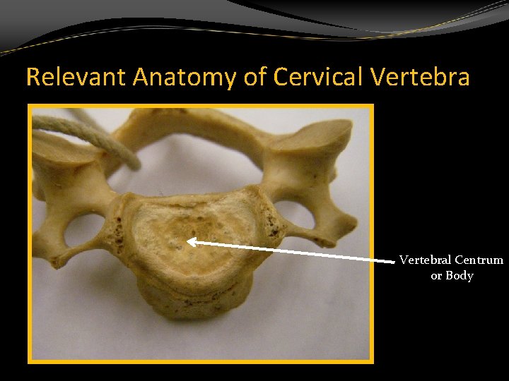 Relevant Anatomy of Cervical Vertebral Centrum or Body 