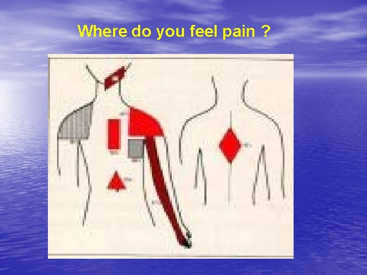 Where do you feel pain ? 