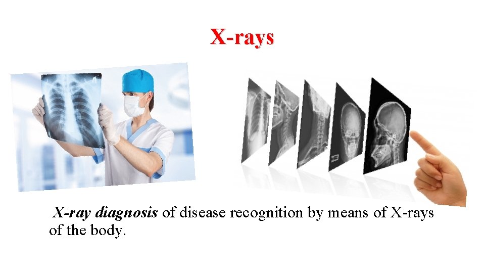 X-rays X-ray diagnosis of disease recognition by means of X-rays of the body. 