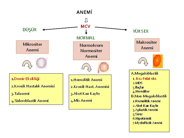 ANEMİ DÜŞÜK MCV NORMAL Mikrositer Anemi Normokrom Normositer Anemi YÜKSEK Makrositer Anemi A. Megaloblastik