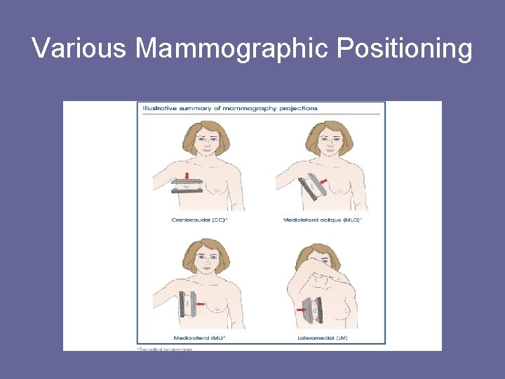 Various Mammographic Positioning 