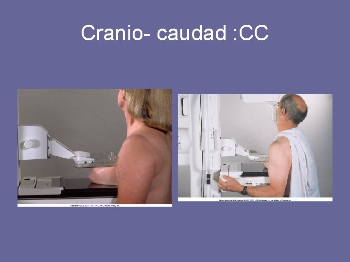 Cranio- caudad : CC 