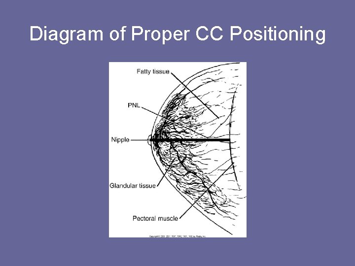 Diagram of Proper CC Positioning 