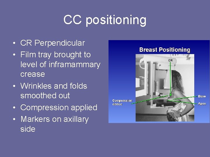 CC positioning • CR Perpendicular • Film tray brought to level of inframammary crease