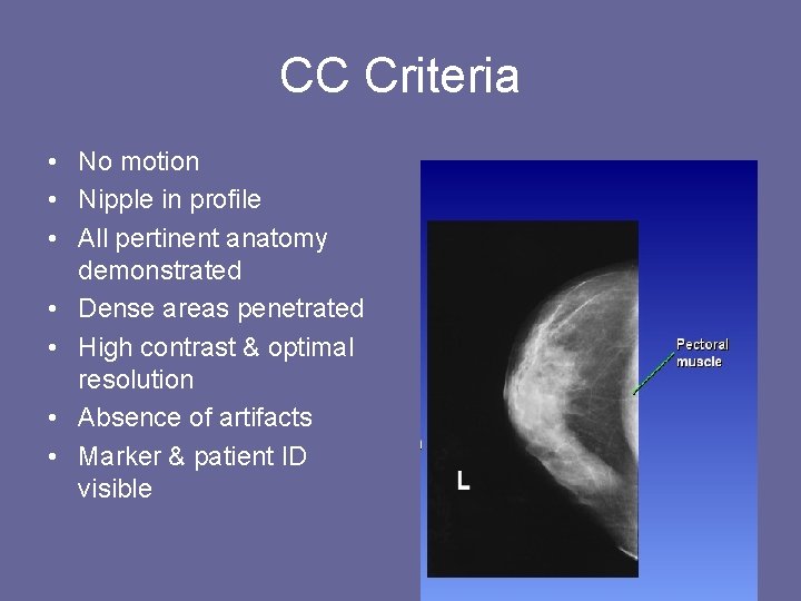 CC Criteria • No motion • Nipple in profile • All pertinent anatomy demonstrated