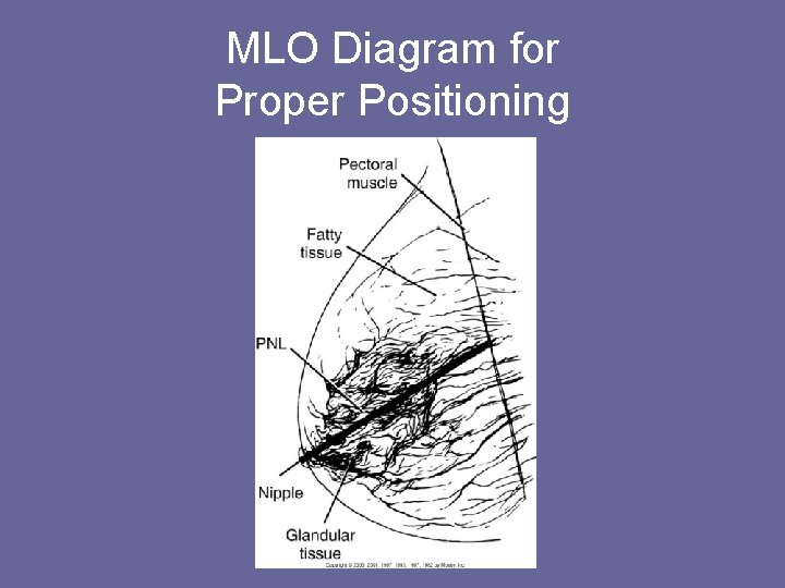 MLO Diagram for Proper Positioning 