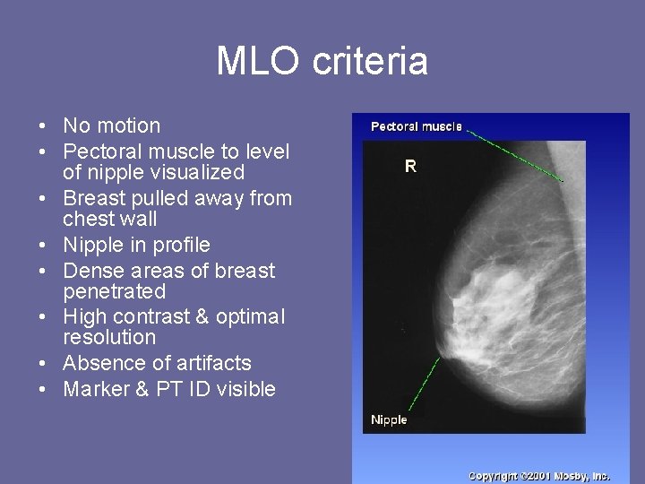 MLO criteria • No motion • Pectoral muscle to level of nipple visualized •