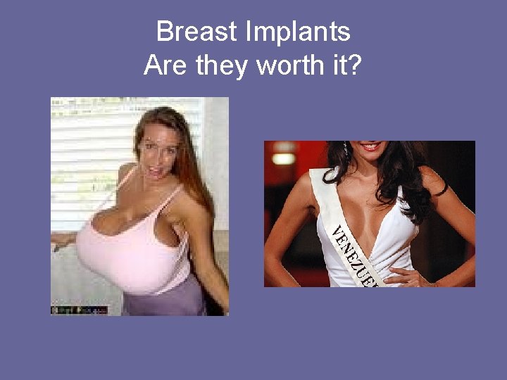 Breast Implants Are they worth it? 