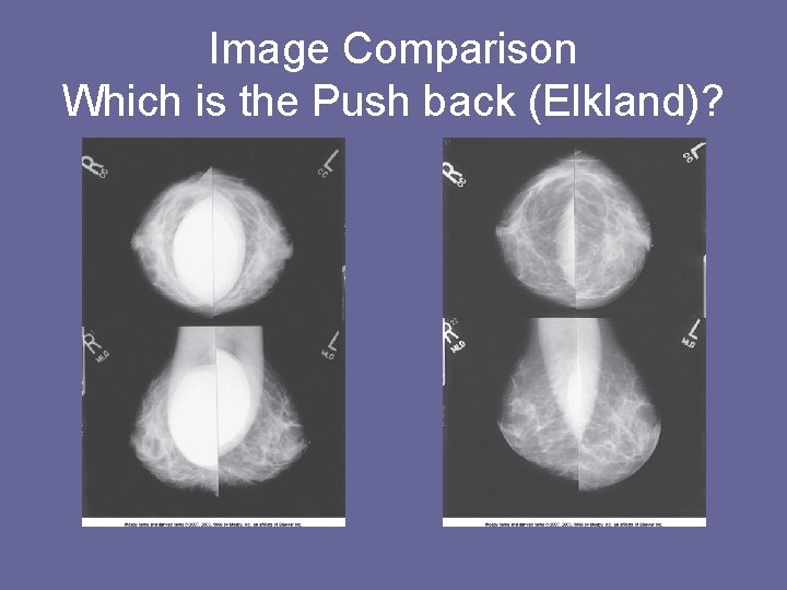 Image Comparison Which is the Push back (Elkland)? 