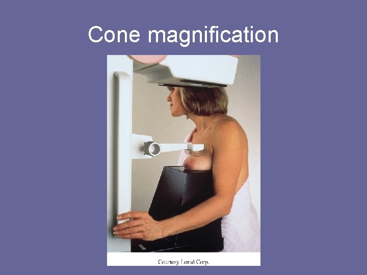 Cone magnification 
