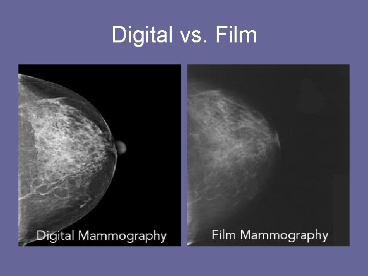 Digital vs. Film 