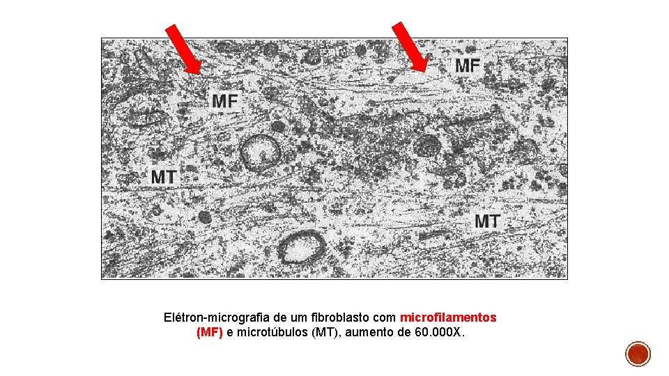 Elétron-micrografia de um fibroblasto com microfilamentos (MF) e microtúbulos (MT), aumento de 60. 000