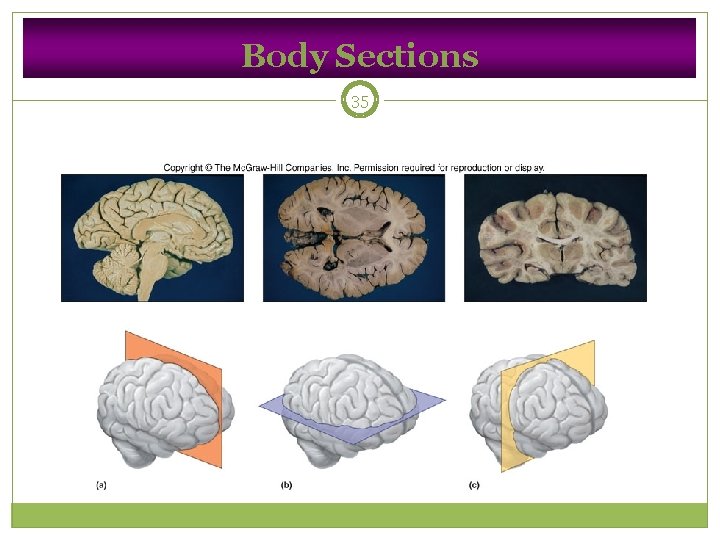 Body Sections 35 