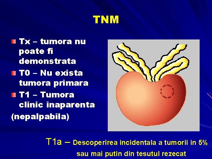 TNM Tx – tumora nu poate fi demonstrata T 0 – Nu exista tumora TNM Tx – tumora nu poate fi demonstrata T 0 – Nu exista tumora
