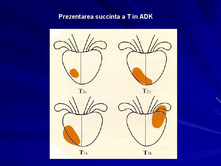 Prezentarea succinta a T in ADK Prezentarea succinta a T in ADK