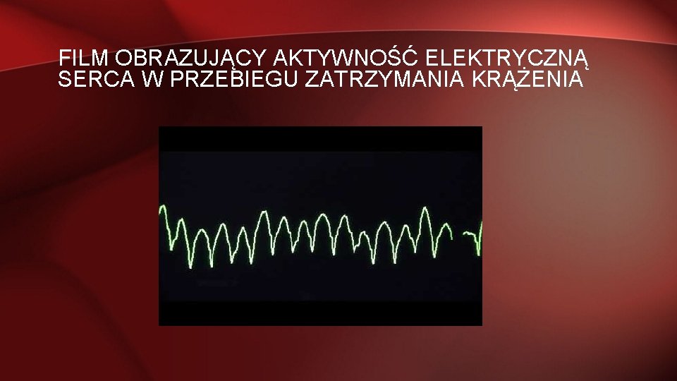 FILM OBRAZUJĄCY AKTYWNOŚĆ ELEKTRYCZNĄ SERCA W PRZEBIEGU ZATRZYMANIA KRĄŻENIA 