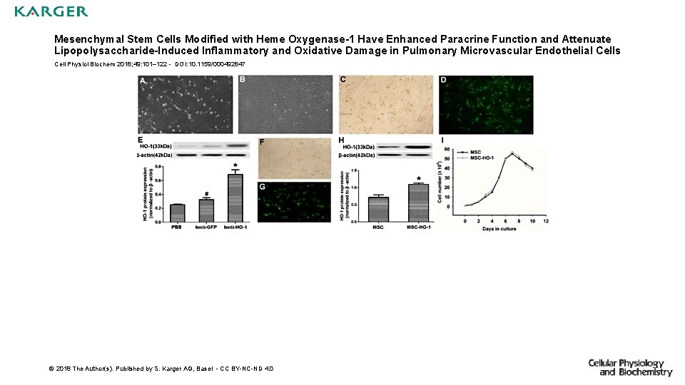 Mesenchymal Stem Cells Modified with Heme Oxygenase-1 Have Enhanced Paracrine Function and Attenuate Lipopolysaccharide-Induced