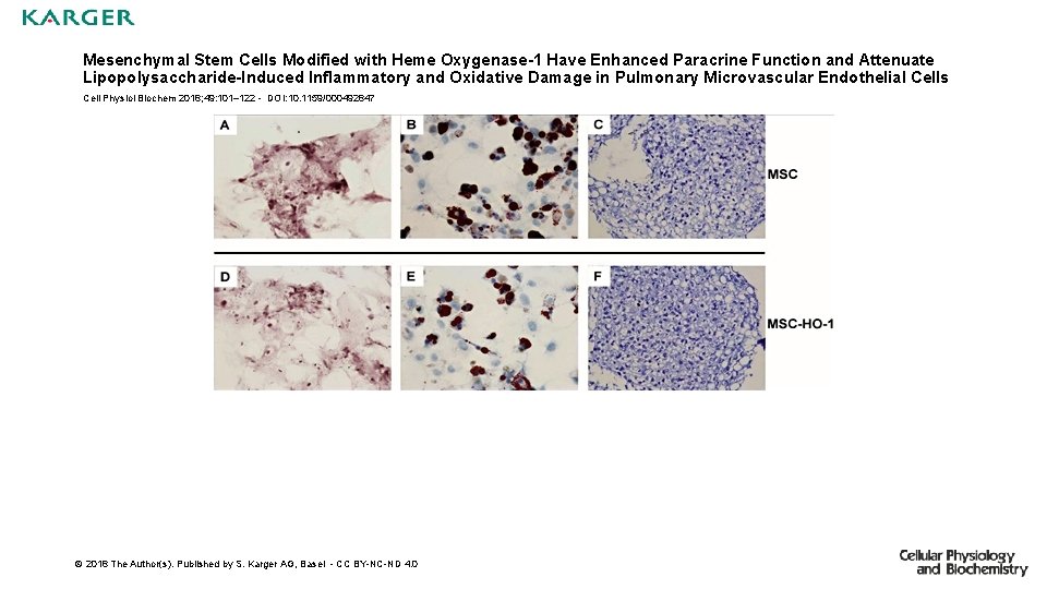 Mesenchymal Stem Cells Modified with Heme Oxygenase-1 Have Enhanced Paracrine Function and Attenuate Lipopolysaccharide-Induced