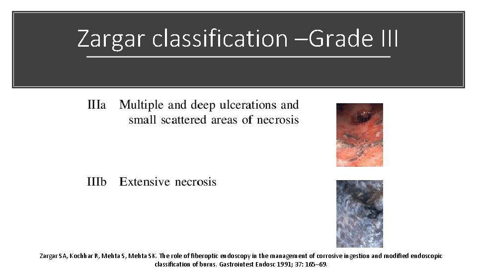 Zargar classification –Grade III Zargar SA, Kochhar R, Mehta SK. The role of fiberoptic