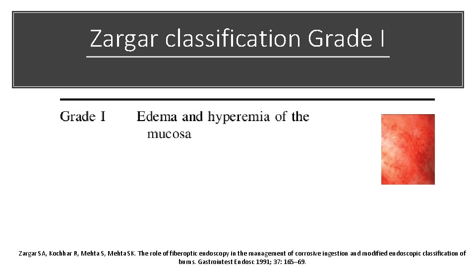 Zargar classification Grade I Zargar SA, Kochhar R, Mehta SK. The role of fiberoptic