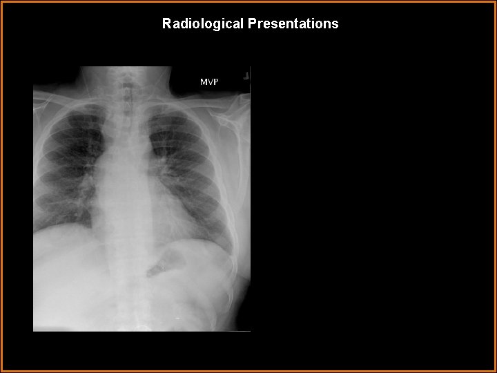 Radiological Presentations 