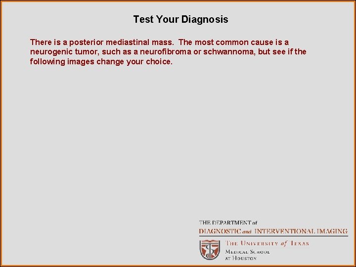 Test Your Diagnosis There is a posterior mediastinal mass. The most common cause is