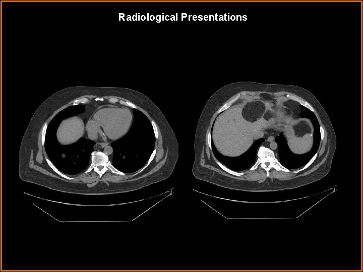 Radiological Presentations 