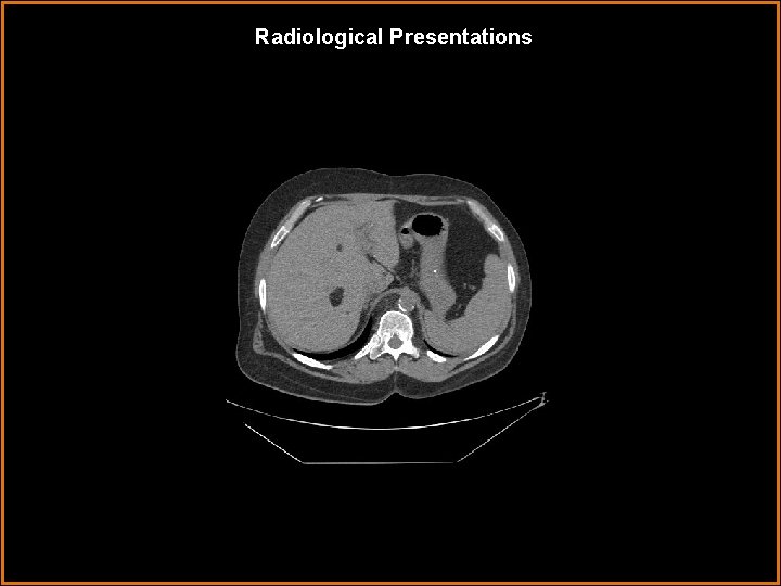 Radiological Presentations 