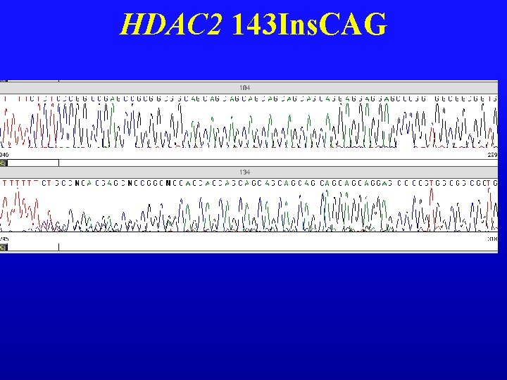 HDAC 2 143 Ins. CAG 