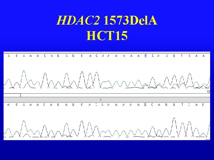 HDAC 2 1573 Del. A HCT 15 