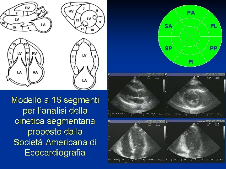 PA SA PL SP PP PI Modello a 16 segmenti per l’analisi della cinetica