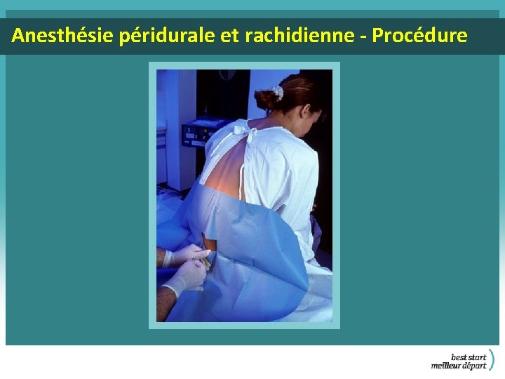 Anesthésie péridurale et rachidienne - Procédure 