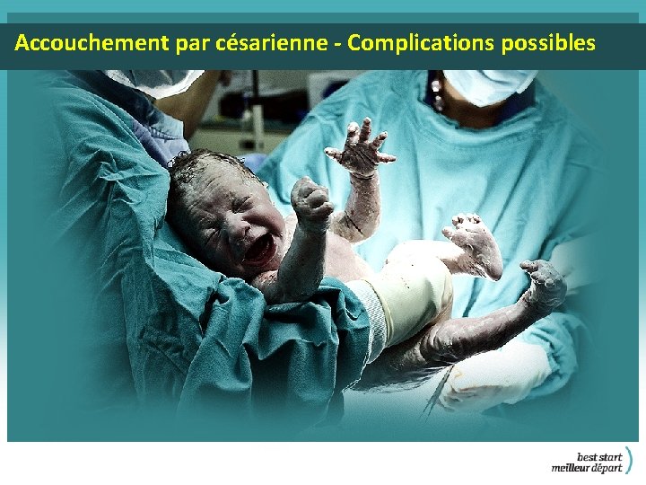 Accouchement par césarienne - Complications possibles 