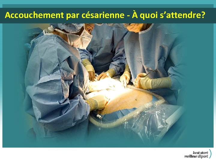 Accouchement par césarienne - À quoi s’attendre? 