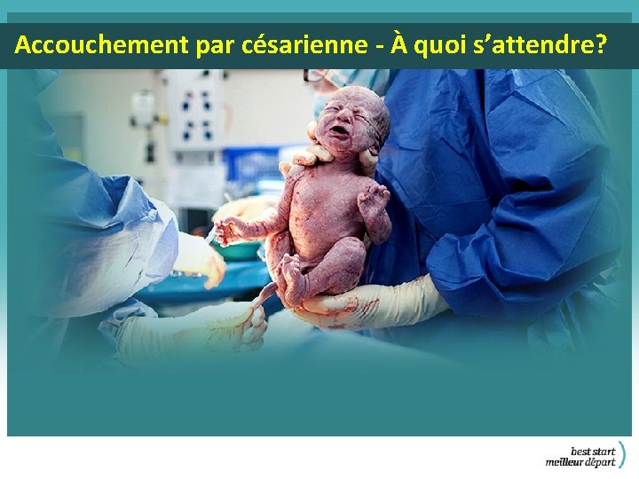 Accouchement par césarienne - À quoi s’attendre? 