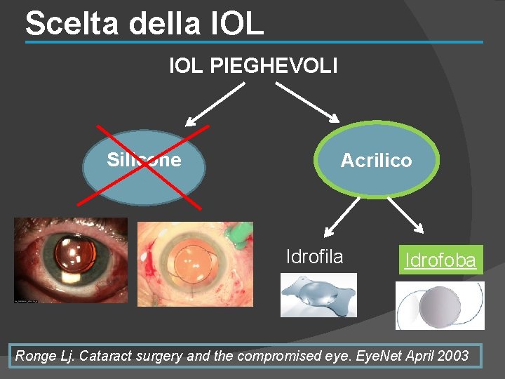 Scelta della IOL PIEGHEVOLI Silicone Acrilico Idrofila Idrofoba Ronge Lj. Cataract surgery and the