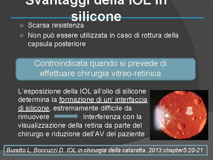 Svantaggi della IOL in silicone v Scarsa resistenza v Non può essere utilizzata in