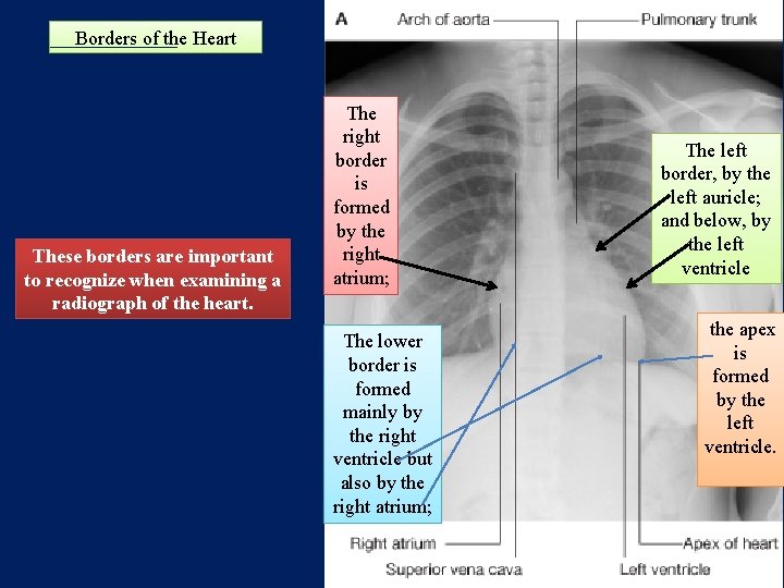 Borders of the Heart These borders are important to recognize when examining a radiograph