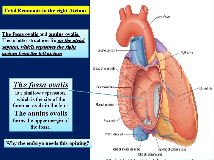 Fetal Remnants in the right Atrium The fossa ovalis and anulus ovalis. These latter