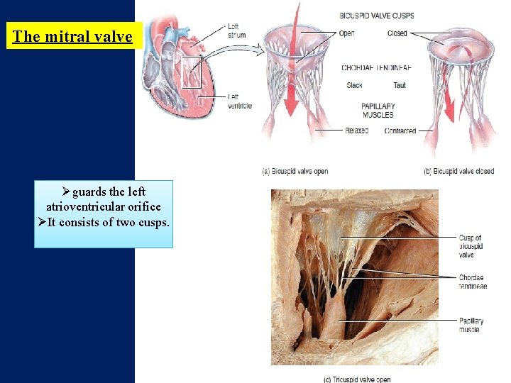 The mitral valve Øguards the left atrioventricular orifice ØIt consists of two cusps. 