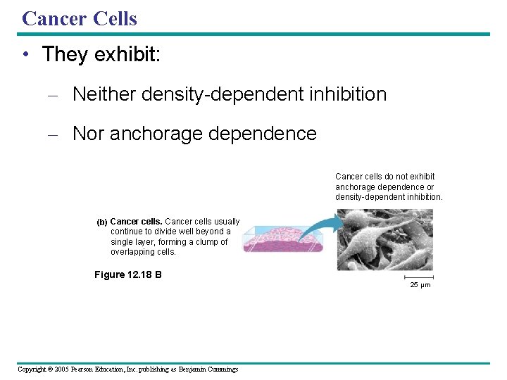 Cancer Cells • They exhibit: – Neither density-dependent inhibition – Nor anchorage dependence Cancer