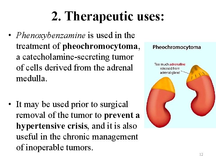 2. Therapeutic uses: • Phenoxybenzamine is used in the treatment of pheochromocytoma, a catecholamine-secreting