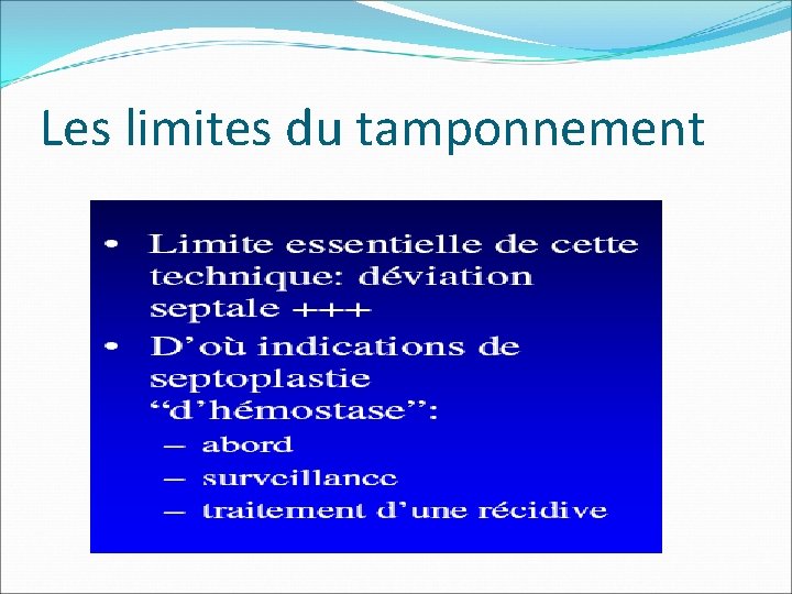 Les limites du tamponnement Les limites du tamponnement