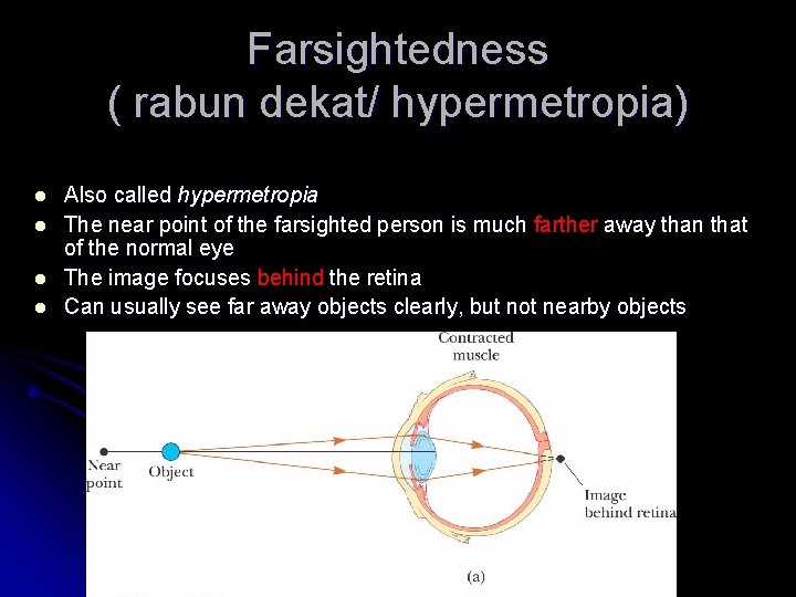 Farsightedness ( rabun dekat/ hypermetropia) l l Also called hypermetropia The near point of