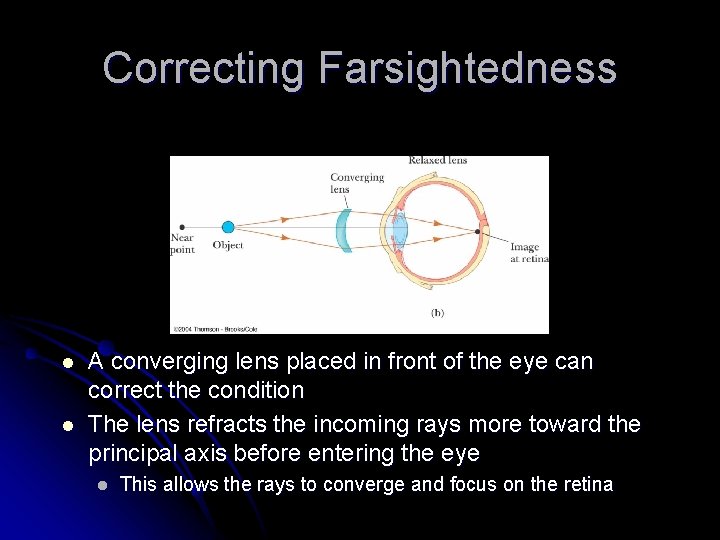 Correcting Farsightedness l l A converging lens placed in front of the eye can